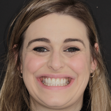 The same MiSmile patient's teeth after Invisalign treatment